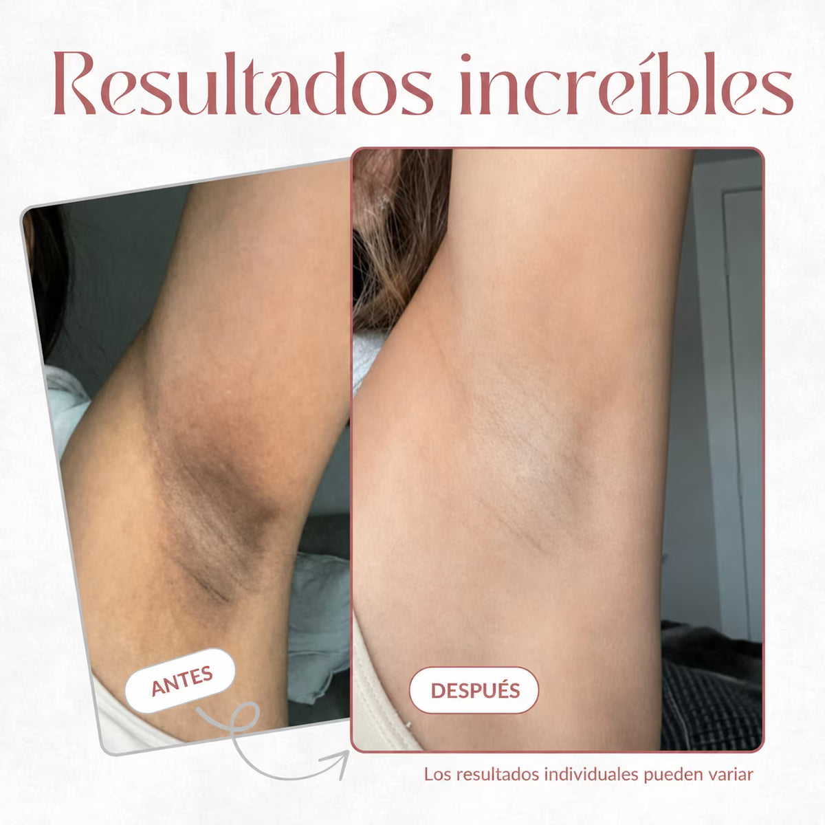 Elimina los Bultos, Manchas y Piel Opaca