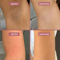 Spray Exfoliante Corporal - Ácido Kójico + Cúrcuma
